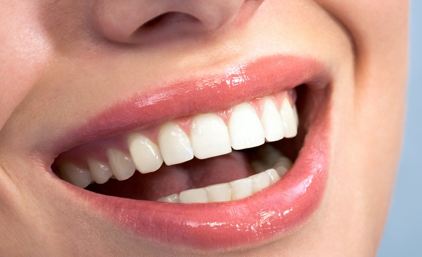 tooth colored bonding mckinney dentist